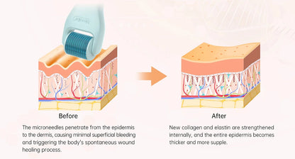 Bio Roller G10 10-in-1 Ultimate Microneedling Kit
